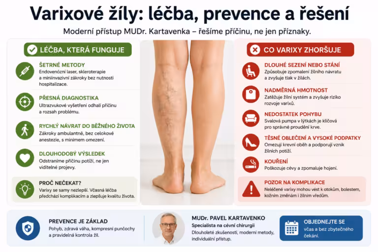 Varixové žíly – jak na léčbu? Kartavenko radí