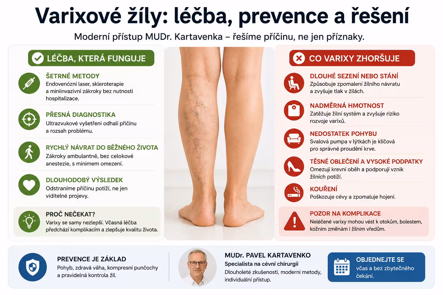 Varixové žíly – jak na léčbu? Kartavenko radí