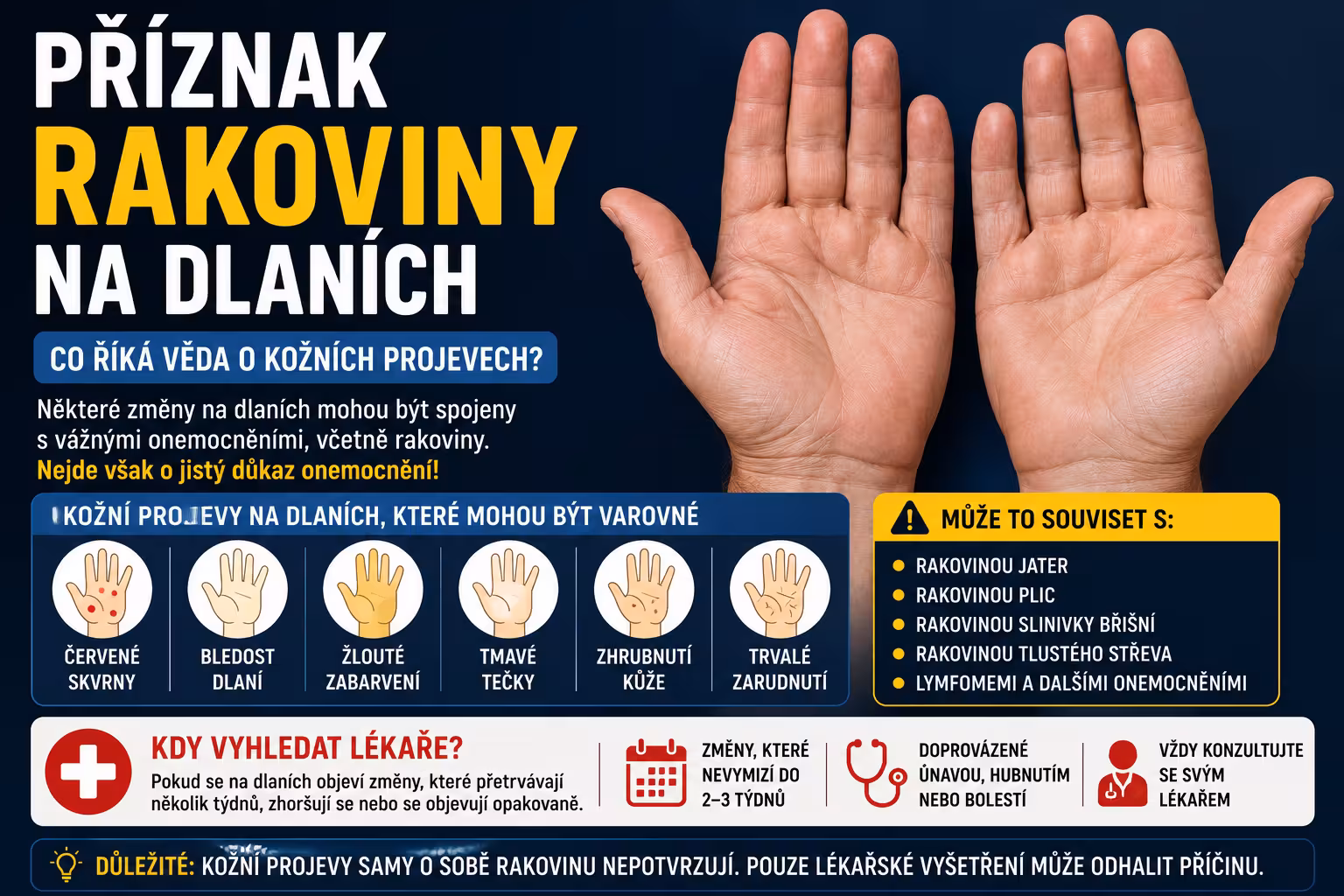 Příznak rakoviny na dlaních? Co říká věda o kožních projevech